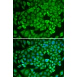 Immunofluorescence - Anti-NR0B1/Dax1 Antibody (A11477) - Antibodies.com