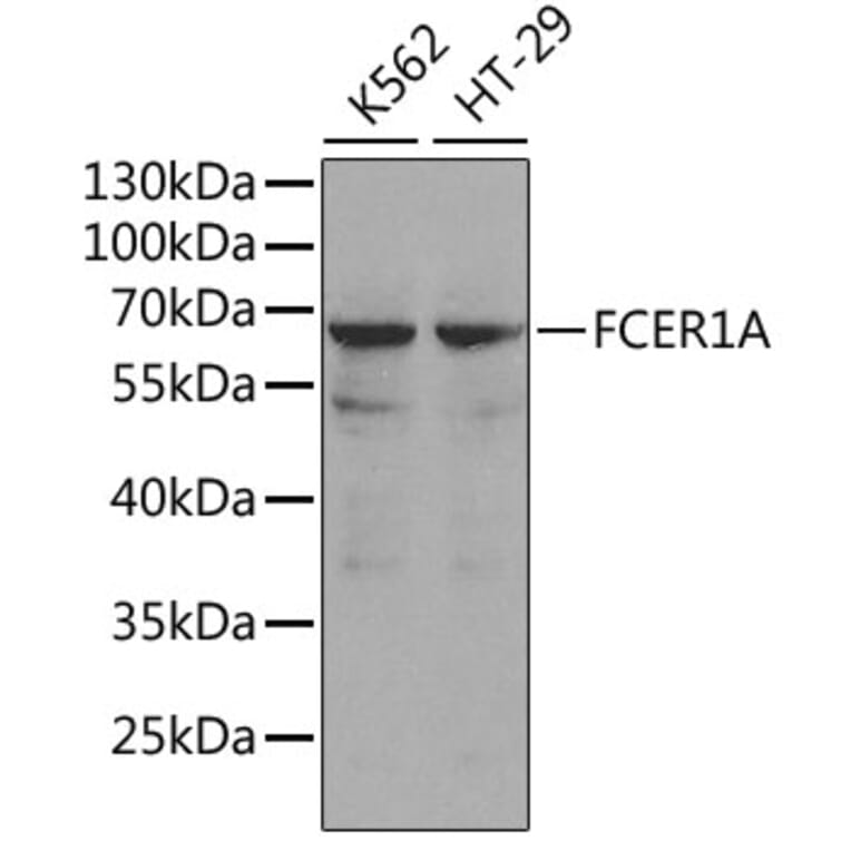 Western Blot - Anti-Fc epsilon RI / FCER1A Antibody (A11478) - Antibodies.com