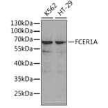 Western Blot - Anti-Fc epsilon RI / FCER1A Antibody (A11478) - Antibodies.com