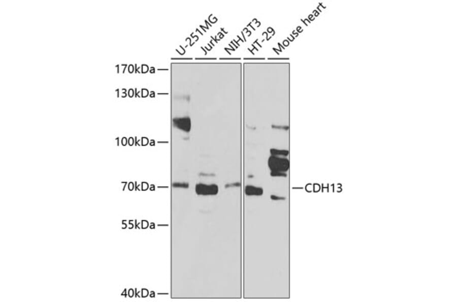 Western Blot - Anti-CDH13 Antibody (A1761) - Antibodies.com