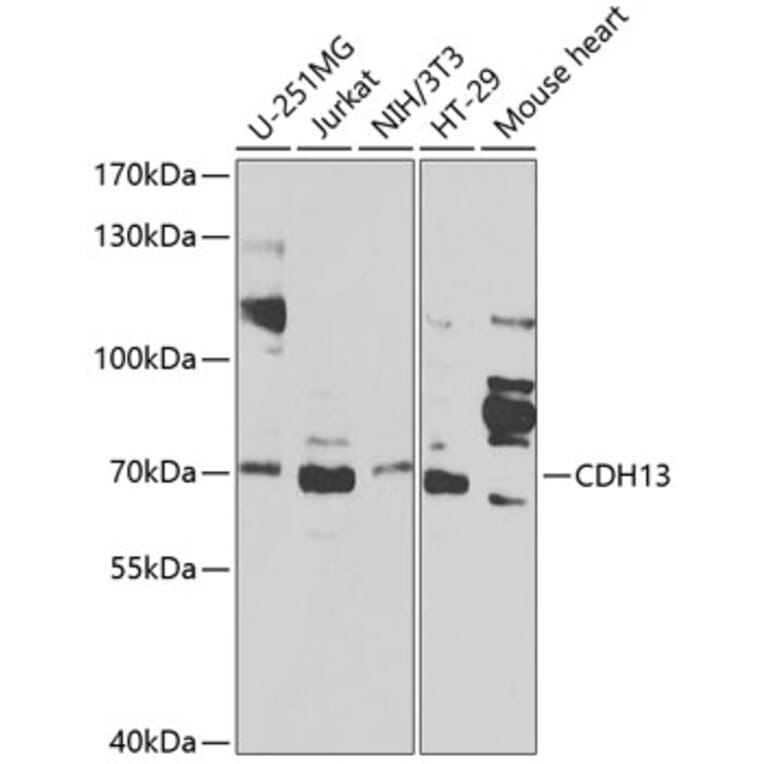 Western Blot - Anti-CDH13 Antibody (A1761) - Antibodies.com