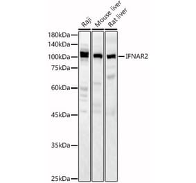 Western Blot - Anti-IFNAR2 Antibody (A11480) - Antibodies.com
