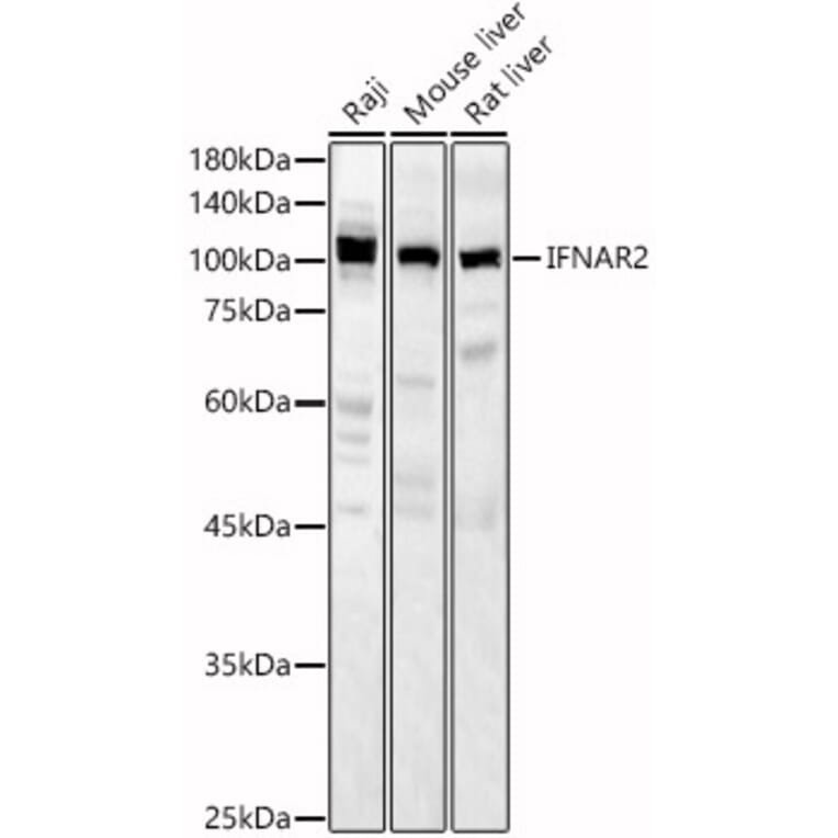 Western Blot - Anti-IFNAR2 Antibody (A11480) - Antibodies.com