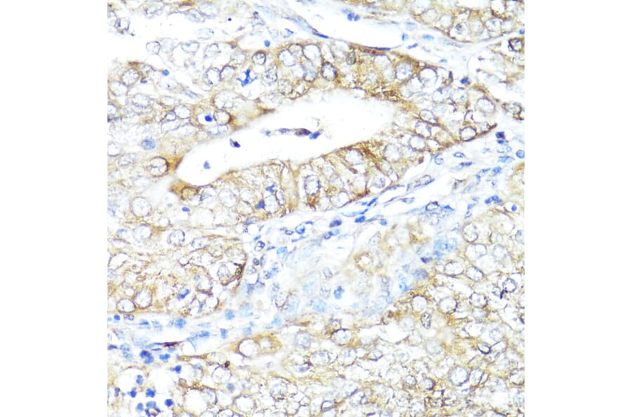 Immunohistochemistry - Anti-IFNAR2 Antibody (A11480) - Antibodies.com