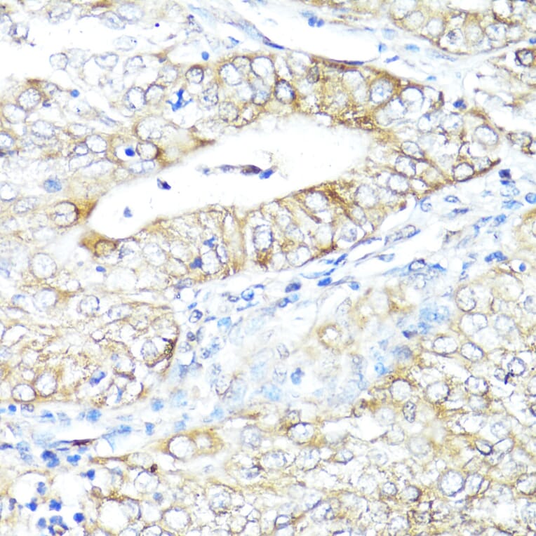 Immunohistochemistry - Anti-IFNAR2 Antibody (A11480) - Antibodies.com