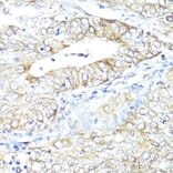 Immunohistochemistry - Anti-IFNAR2 Antibody (A11480) - Antibodies.com