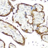 Immunohistochemistry - Anti-IFNAR2 Antibody (A11480) - Antibodies.com
