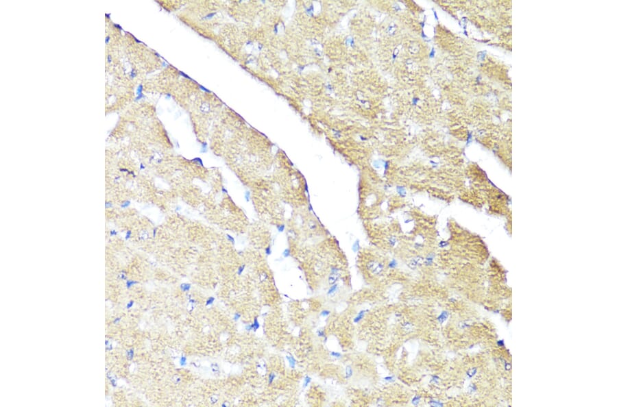 Immunohistochemistry - Anti-IFNAR2 Antibody (A11480) - Antibodies.com