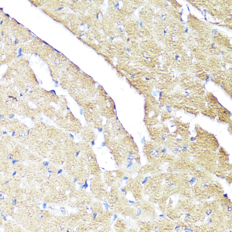 Immunohistochemistry - Anti-IFNAR2 Antibody (A11480) - Antibodies.com