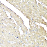 Immunohistochemistry - Anti-IFNAR2 Antibody (A11480) - Antibodies.com