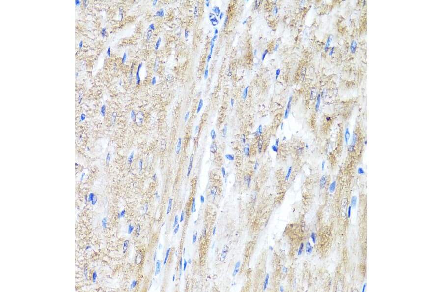 Immunohistochemistry - Anti-IFNAR2 Antibody (A11480) - Antibodies.com