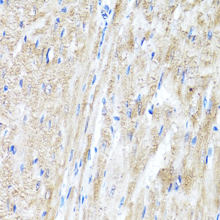 Immunohistochemistry - Anti-IFNAR2 Antibody (A11480) - Antibodies.com