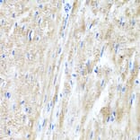 Immunohistochemistry - Anti-IFNAR2 Antibody (A11480) - Antibodies.com