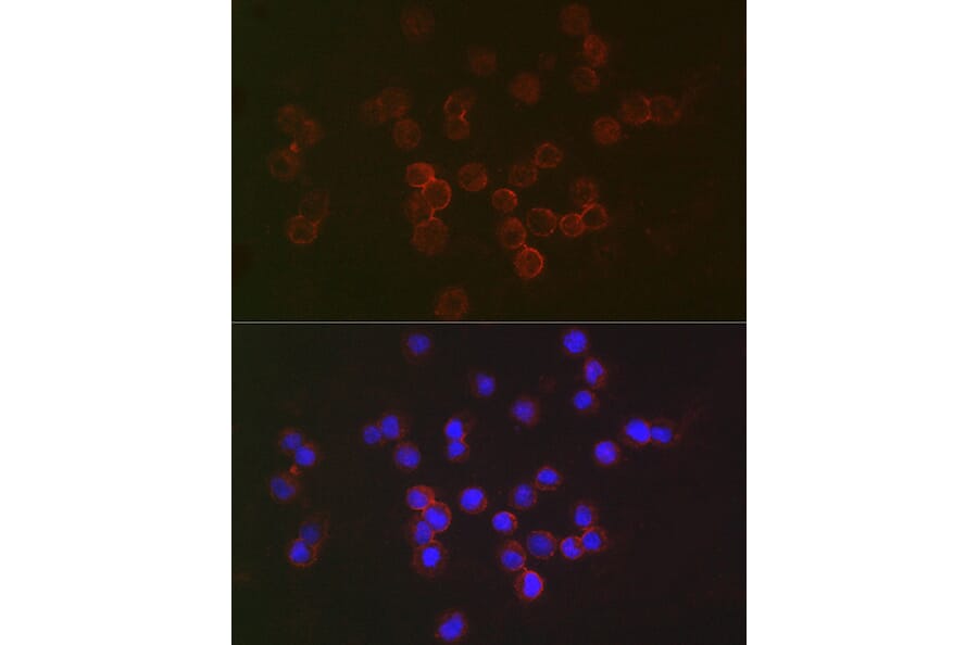 Immunofluorescence - Anti-IFNAR2 Antibody (A11480) - Antibodies.com