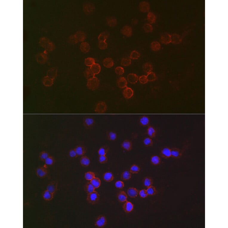 Immunofluorescence - Anti-IFNAR2 Antibody (A11480) - Antibodies.com