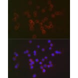 Immunofluorescence - Anti-IFNAR2 Antibody (A11480) - Antibodies.com
