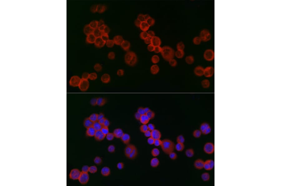 Immunofluorescence - Anti-IFNAR2 Antibody (A11480) - Antibodies.com