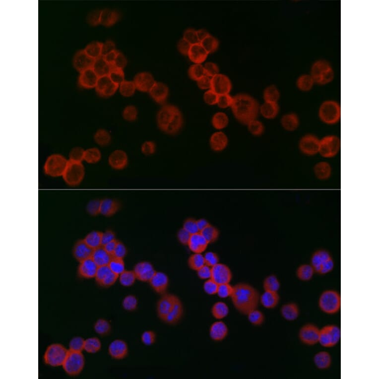 Immunofluorescence - Anti-IFNAR2 Antibody (A11480) - Antibodies.com
