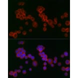 Immunofluorescence - Anti-IFNAR2 Antibody (A11480) - Antibodies.com