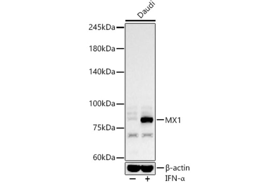 Western Blot - Anti-MX1 Antibody (A11481) - Antibodies.com