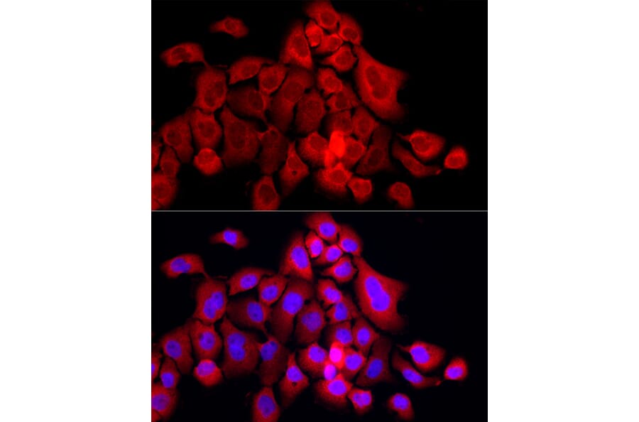 Immunofluorescence - Anti-MX1 Antibody (A11481) - Antibodies.com