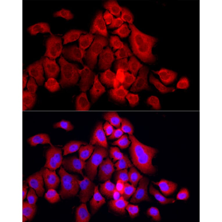 Immunofluorescence - Anti-MX1 Antibody (A11481) - Antibodies.com