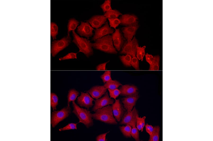 Immunofluorescence - Anti-MX1 Antibody (A11481) - Antibodies.com