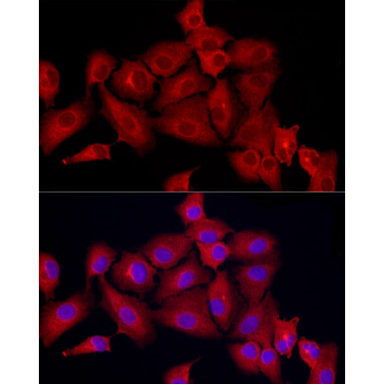 Immunofluorescence - Anti-MX1 Antibody (A11481) - Antibodies.com