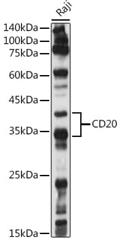 Western blot analysis of extracts of various cell lines, using Anti-MS4A1 Antibody (A1793) at 1:1,000 dilution.
Secondary antibody: Goat Anti-Rabbit IgG (H+L) (HRP) (AS014) at 1:10,000 dilution.
Lysates / proteins: 25µg per lane.
Blocking buffer: 3% non-fat dry milk in TBST.
Detection: ECL Basic Kit (RM00020).
Exposure time: 10s.