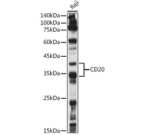 Western Blot - Anti-CD20 Antibody (A11482) - Antibodies.com