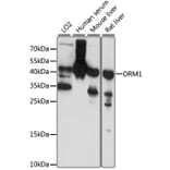 Western Blot - Anti-ORM1 Antibody (A1799) - Antibodies.com