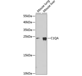 Western Blot - Anti-C1QA Antibody (A11484) - Antibodies.com