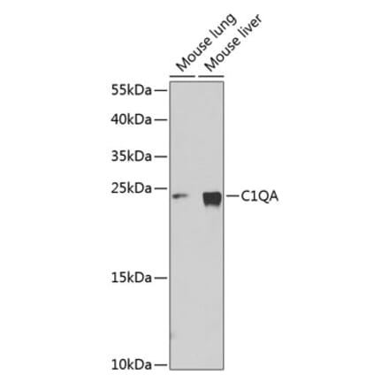 Western Blot - Anti-C1QA Antibody (A11484) - Antibodies.com