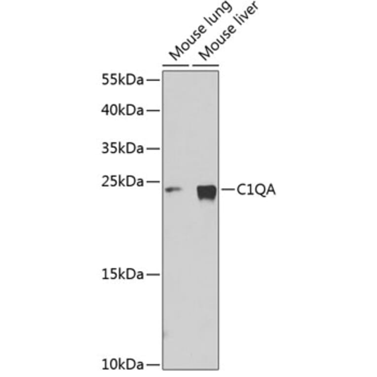 Western Blot - Anti-C1QA Antibody (A11484) - Antibodies.com