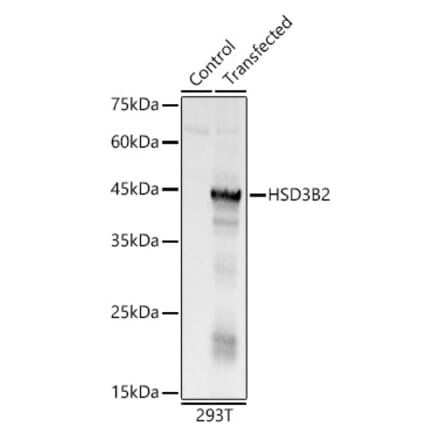 Western Blot - Anti-HSD3B2 Antibody (A11485) - Antibodies.com