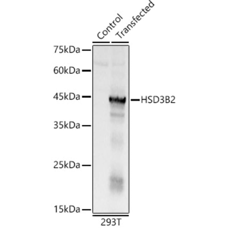 Western Blot - Anti-HSD3B2 Antibody (A11485) - Antibodies.com