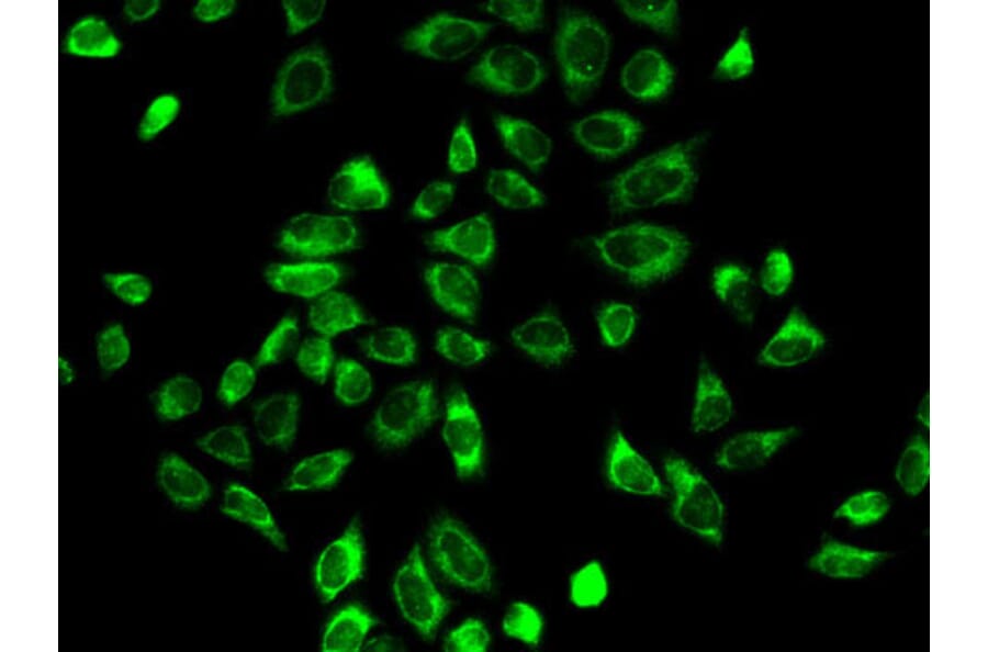 Immunofluorescence - Anti-HSD3B2 Antibody (A11485) - Antibodies.com