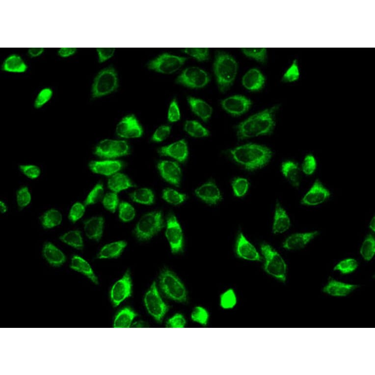 Immunofluorescence - Anti-HSD3B2 Antibody (A11485) - Antibodies.com