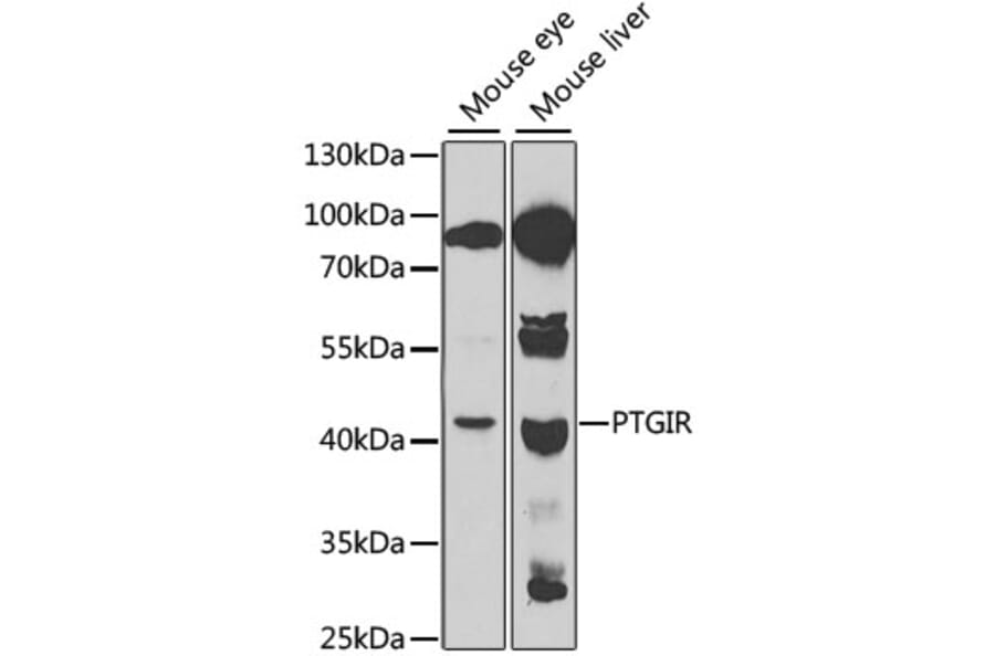 Western Blot - Anti-Prostacyclin receptor Antibody (A11486) - Antibodies.com