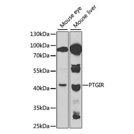 Western Blot - Anti-Prostacyclin receptor Antibody (A11486) - Antibodies.com