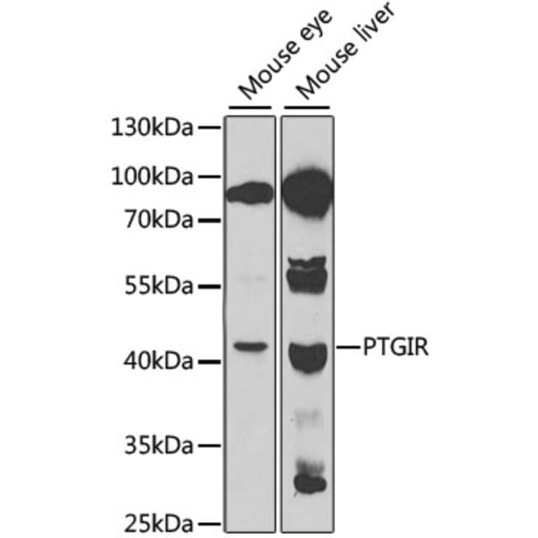 Western Blot - Anti-Prostacyclin receptor Antibody (A11486) - Antibodies.com