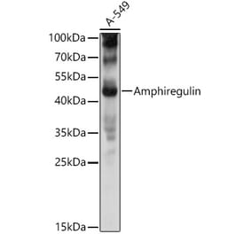 Western Blot - Anti-Amphiregulin Antibody (A11487) - Antibodies.com