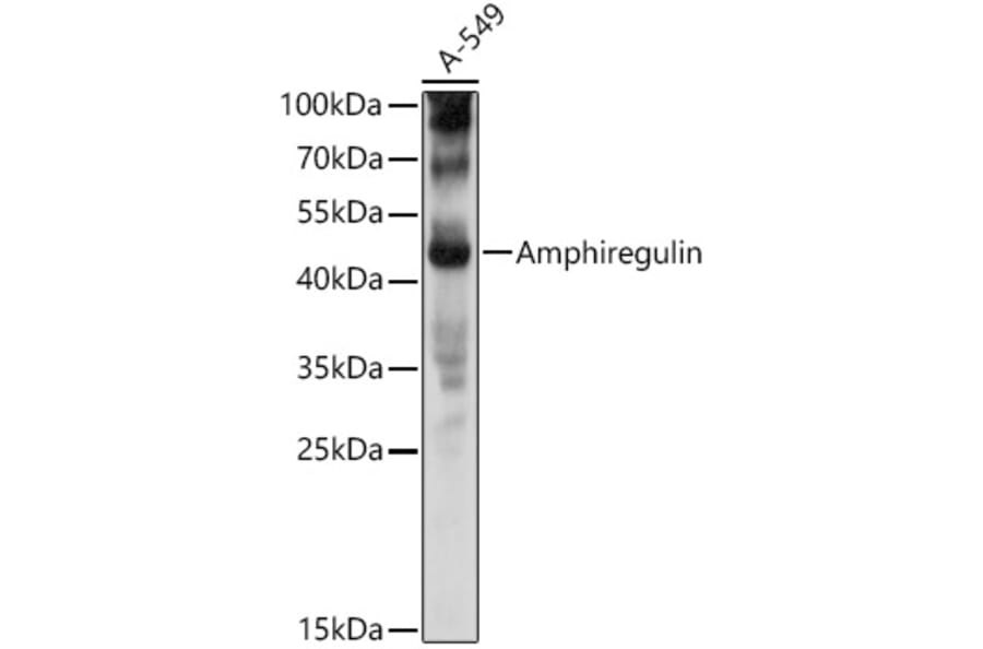 Western Blot - Anti-Amphiregulin Antibody (A11487) - Antibodies.com