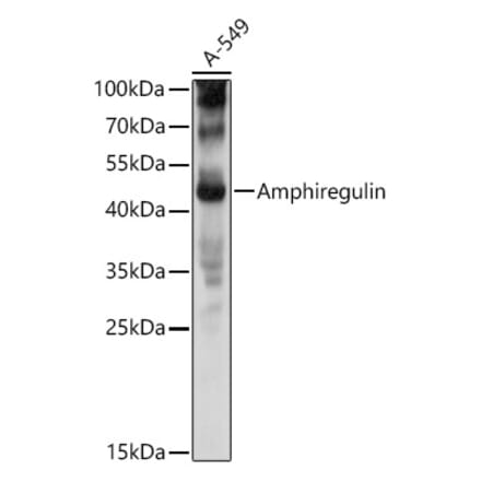 Western Blot - Anti-Amphiregulin Antibody (A11487) - Antibodies.com