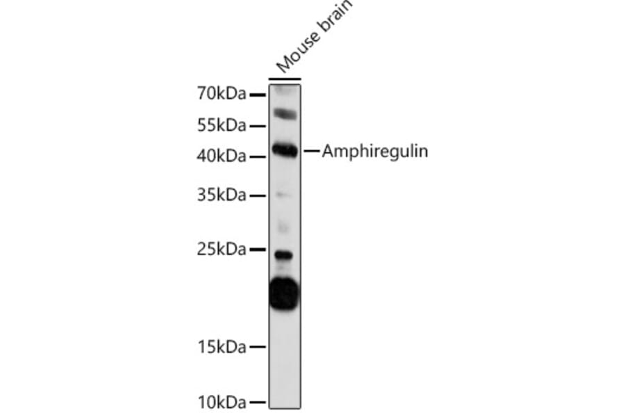 Western Blot - Anti-Amphiregulin Antibody (A11487) - Antibodies.com