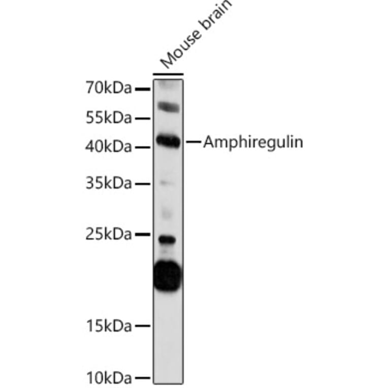 Western Blot - Anti-Amphiregulin Antibody (A11487) - Antibodies.com