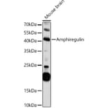 Western Blot - Anti-Amphiregulin Antibody (A11487) - Antibodies.com