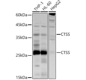 Western Blot - Anti-Cathepsin S Antibody (A11488) - Antibodies.com