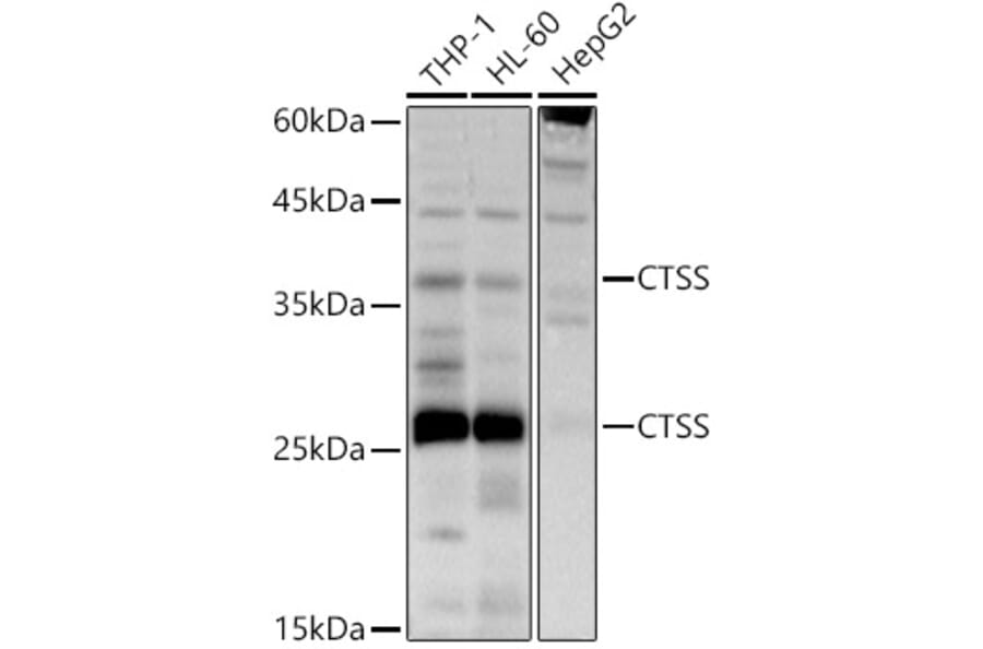 Western Blot - Anti-Cathepsin S Antibody (A11488) - Antibodies.com