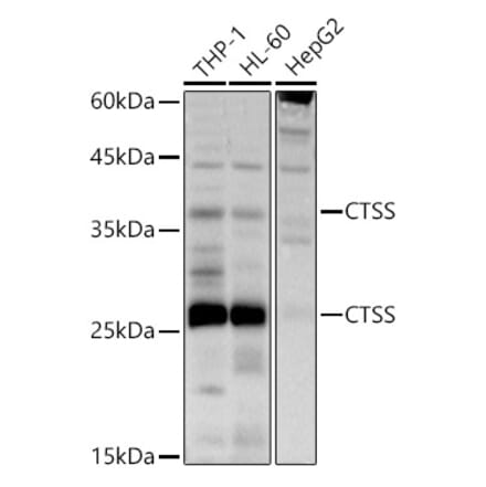 Western Blot - Anti-Cathepsin S Antibody (A11488) - Antibodies.com